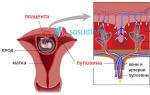 What blood flow problems occur during pregnancy What is decreased blood flow during pregnancy