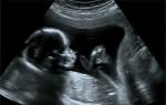 Kedy začínajú pohyby plodu počas tehotenstva a ako ich rozpoznať?