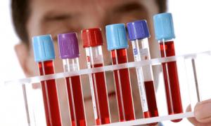 Ce arată un test de sânge hCG și cum să vă pregătiți pentru un test hCG 10 există o sarcină