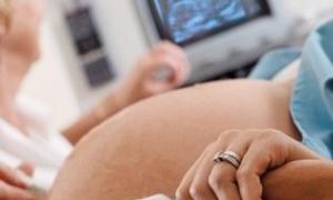 Presentación de nalgas del feto: ¿parto natural o cesárea?
