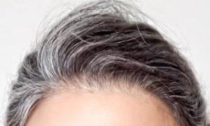 Gray hair in young men - reasons for its appearance