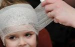 What to do if a child hit the back of the head: what to look for and what are the consequences of a head injury?
