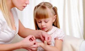 How to remove a splinter from a child - all the ways!